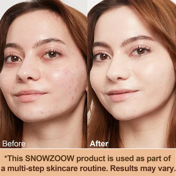 🔥2026 Hot Sale 40% OFF✨⚡ 50K+ SOLD! 🎁4-in-1 Perfecting Foundation – High Coverage, SPF & All-Day Hydration 🤍✨ - Image 10