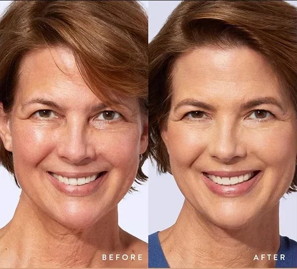 🔥2026 Hot Sale 40% OFF✨⚡ 50K+ SOLD! 🎁4-in-1 Perfecting Foundation – High Coverage, SPF & All-Day Hydration 🤍✨ - Image 6