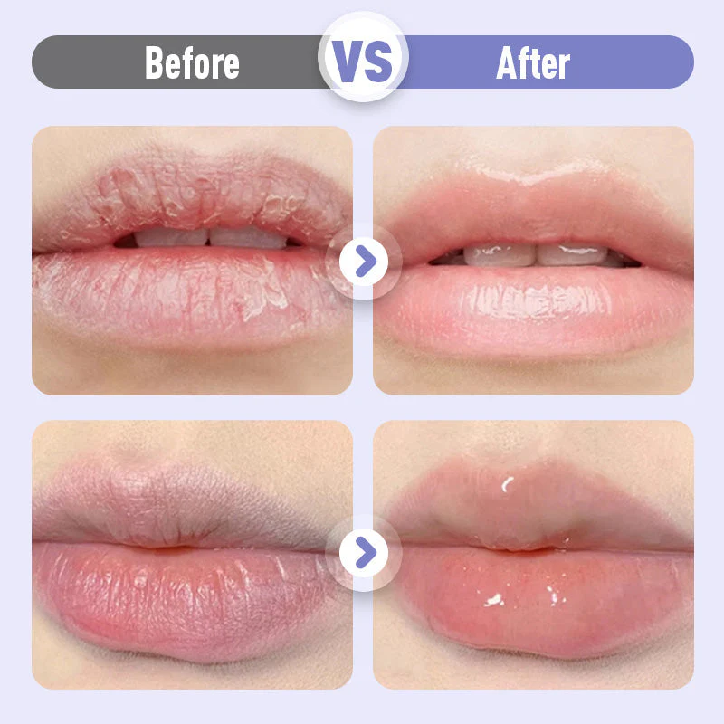 🏆Flash Sale⚡30K+ SOLD!Plumping & Anti-Wrinkle Hydrating Lip Serum - Image 6